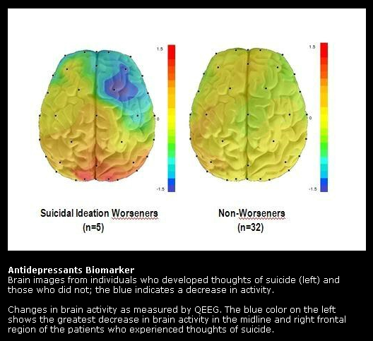 Depression getting worse