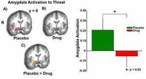 amygdala-activation-to-threat.jpg