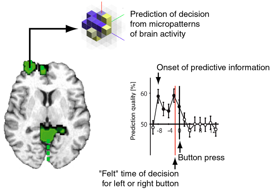 Решение brain