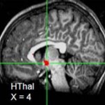 Hypothalamus, a node of the emotion circuit. (Credit: Image courtesy of NIH/National Institute of Mental Health)